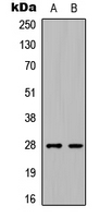 Rabbit Polyclonal Antibody to C1QL3