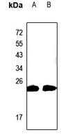 Rabbit Polyclonal Antibody to CABP2