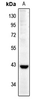 Rabbit Polyclonal Antibody to CTSW