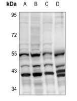 Rabbit Polyclonal Antibody to CYP27C1