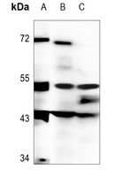 Rabbit Polyclonal Antibody to DMRTA1