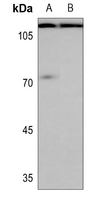 Rabbit Polyclonal Antibody to TMPRSS15