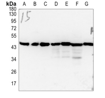 Rabbit Polyclonal Antibody to FOXD4L5