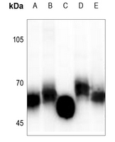 Rabbit Polyclonal Antibody to GGT5