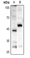 Rabbit Polyclonal Antibody to GPR85