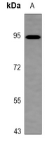 Rabbit Polyclonal Antibody to ITIH3