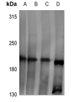 Rabbit Polyclonal Antibody to LPHN2