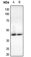 Rabbit Polyclonal Antibody to CCRN4L