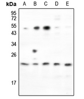 Rabbit Polyclonal Antibody to RND2