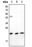 Rabbit Polyclonal Antibody to TNFAIP8L1