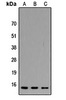Rabbit Polyclonal Antibody to ATP5J2