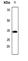 Rabbit Polyclonal Antibody to CA8