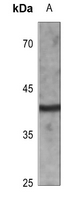 Rabbit Polyclonal Antibody to CD72
