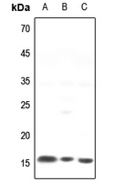 Rabbit Polyclonal Antibody to NCALD
