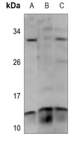 Rabbit Polyclonal Antibody to PAGE3