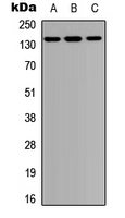 Rabbit Polyclonal Antibody to PTPN21