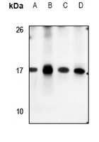 Rabbit Polyclonal Antibody to S100A7