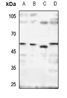 Rabbit Polyclonal Antibody to SH2D4A
