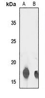 Rabbit Polyclonal Antibody to TCEAL8