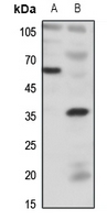 Rabbit Polyclonal Antibody to BDKRB1