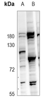 Rabbit Polyclonal Antibody to GPR97