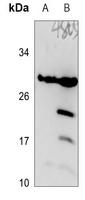 Rabbit Polyclonal Antibody to DHRS11