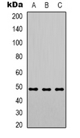 Rabbit Polyclonal Antibody to PSMC3