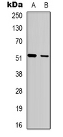 Rabbit Polyclonal Antibody to SH2D2A