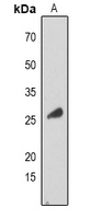 Rabbit Polyclonal Antibody to RAB34