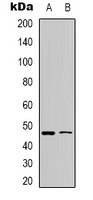 Rabbit Polyclonal Antibody to WWOX