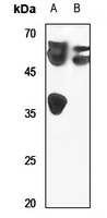 Rabbit Polyclonal Antibody to LUC7L2