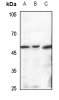 Rabbit Polyclonal Antibody to TBL2