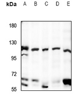 Rabbit Polyclonal Antibody to UBE3B