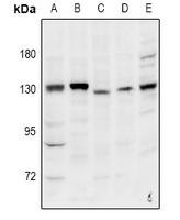Rabbit Polyclonal Antibody to INTS2