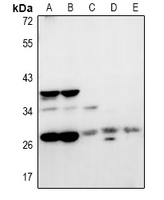 Rabbit Polyclonal Antibody to NRBF2