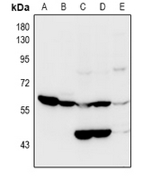 Rabbit Polyclonal Antibody to SLC22A5