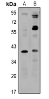 Rabbit Polyclonal Antibody to SLC30A8