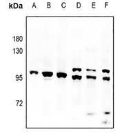 Rabbit Polyclonal Antibody to PAPOLA