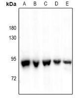 Rabbit Polyclonal Antibody to ALDH18A1