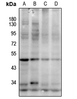 Rabbit Polyclonal Antibody to CTSW