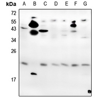 Rabbit Polyclonal Antibody to VEGFA