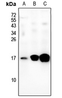 Rabbit Polyclonal Antibody to BLCAP
