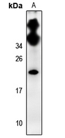 Rabbit Polyclonal Antibody to TMEM30CP