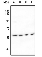 Rabbit Polyclonal Antibody to IFIT1