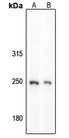 Rabbit Polyclonal Antibody to GON4L