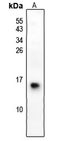 Rabbit Polyclonal Antibody to S100G