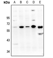 Rabbit Polyclonal Antibody to NFATC2IP