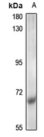Rabbit Polyclonal Antibody to CDK5RAP1