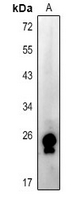 Rabbit Polyclonal Antibody to RAB15