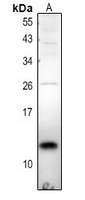 Rabbit Polyclonal Antibody to TCEAL7